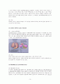 염색체 이상으로 생기는 질병종류, 원인, 치료방법 12페이지