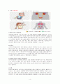 골수종케이스 4페이지
