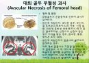 OS 진단명,정형외과 컨퍼런스 26페이지