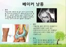 OS 진단명,정형외과 컨퍼런스 34페이지