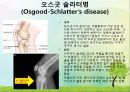 OS 진단명,정형외과 컨퍼런스 39페이지