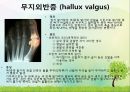 OS 진단명,정형외과 컨퍼런스 40페이지