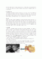 난청 및 돌발성 난청 case study 케이스 스터디 15페이지