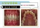 임산부 구강보건교육.ppt 6페이지