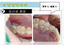 임산부 구강보건교육.ppt 7페이지