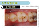 임산부 구강보건교육.ppt 8페이지