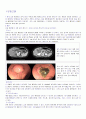 [케이스스터디(case study)] 급성췌장염(Acute Pancreatitis) 문헌고찰, 간호사정(건강사정), 약물, 진단검사, 간호과정 2페이지