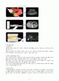 CBD Ca, ampullary ca, ERCP , ,  담도암(담관암) CBD cancer 케이스 스터디 3페이지