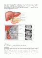 CBD Ca, ampullary ca, ERCP , ,  담도암(담관암) CBD cancer 케이스 스터디 4페이지