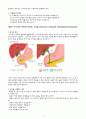 CBD Ca, ampullary ca, ERCP , ,  담도암(담관암) CBD cancer 케이스 스터디 7페이지