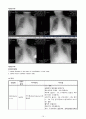 CBD Ca, ampullary ca, ERCP , ,  담도암(담관암) CBD cancer 케이스 스터디 13페이지