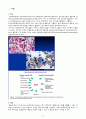 Hemophagocytic lymphohistiocytosis (HLH, 혈구탐식성 림프조직구증후군) 케이스 스터디(case study) 2페이지