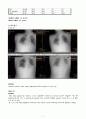 Hemophagocytic lymphohistiocytosis (HLH, 혈구탐식성 림프조직구증후군) 케이스 스터디(case study) 7페이지