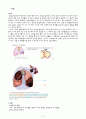 간질 성 폐질환 ILD : Interstitial lung disease 케이스 스터디 (Case Study) 2페이지