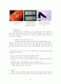 [암간호] 위암 (암의 정의 및 발생률, 위의 위치와 구조, 위암의 정의 및 종류, 위암의 발생빈도, 위험요인, 증상, 병기별 분류, 진단 방법, 치료 방법, 치료의 부작용, 재발 및 전이, 치료 현황, 예방법) 10페이지