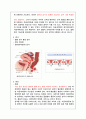 자궁내막증 case study 5페이지