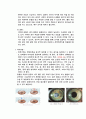 안과병동 각막이영양증 케이스스터디 7페이지