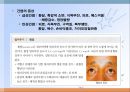 간, 담낭 및 췌장 질환(임상영양학, 간질환, 담도계질환, 췌장질환) PPT, 파워포인트 10페이지