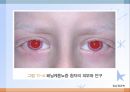 내분비 및 선천성 대사장애 질환(임상영양학, 내분비질환, 선천성대사장애) PPT, 파워포인트 18페이지
