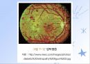 당뇨병(임상영양학, 당뇨병의정의, 당뇨병의진단, 당뇨병합병증, 당뇨병치료) PPT, 파워포인트 38페이지