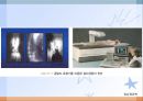신경 및 골격계 질환(임상영양학, 치매, 정신분열증, 월경전증후군, 골다공증) PPT, 파워포인트 37페이지