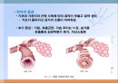 호흡기질환(임상영양학, 호흡기구조, 호흡기질환종류, 치료, 약물치료) PPT, 파워포인트 10페이지
