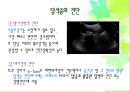 [담석 (Gallstone)]  담석과 담석증의 정의, 담석증의 원인,담석 종류별 기전, 담석증의 증상, 담석증의 진단, 담석증의 치료법과 예방법.pptx 17페이지