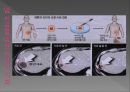 바이오테크놀로지와 생명윤리-인간게놈프로젝트,유전자치료,인공장기,멘델,레벤후크,바이오테크놀로지의 역사 17페이지