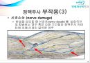 정맥주사요법 (부위,과정,부작용,영상) 18페이지