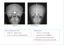 방사선사 국가고시 일반촬영 정리 (일반 영상검사, 일반 촬영, Lower extremity, Hip & pelvis, Spine, Mamo 촬영, 일반촬영 모의고사).ppt 2페이지