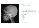 방사선사 국가고시 일반촬영 정리 (일반 영상검사, 일반 촬영, Lower extremity, Hip & pelvis, Spine, Mamo 촬영, 일반촬영 모의고사).ppt 3페이지