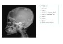 방사선사 국가고시 일반촬영 정리 (일반 영상검사, 일반 촬영, Lower extremity, Hip & pelvis, Spine, Mamo 촬영, 일반촬영 모의고사).ppt 4페이지