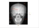 방사선사 국가고시 일반촬영 정리 (일반 영상검사, 일반 촬영, Lower extremity, Hip & pelvis, Spine, Mamo 촬영, 일반촬영 모의고사).ppt 5페이지
