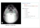 방사선사 국가고시 일반촬영 정리 (일반 영상검사, 일반 촬영, Lower extremity, Hip & pelvis, Spine, Mamo 촬영, 일반촬영 모의고사).ppt 8페이지