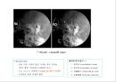 방사선사 국가고시 일반촬영 정리 (일반 영상검사, 일반 촬영, Lower extremity, Hip & pelvis, Spine, Mamo 촬영, 일반촬영 모의고사).ppt 14페이지