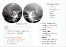 방사선사 국가고시 일반촬영 정리 (일반 영상검사, 일반 촬영, Lower extremity, Hip & pelvis, Spine, Mamo 촬영, 일반촬영 모의고사).ppt 15페이지
