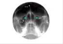 방사선사 국가고시 일반촬영 정리 (일반 영상검사, 일반 촬영, Lower extremity, Hip & pelvis, Spine, Mamo 촬영, 일반촬영 모의고사).ppt 21페이지