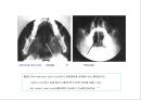방사선사 국가고시 일반촬영 정리 (일반 영상검사, 일반 촬영, Lower extremity, Hip & pelvis, Spine, Mamo 촬영, 일반촬영 모의고사).ppt 22페이지