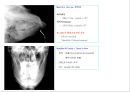 방사선사 국가고시 일반촬영 정리 (일반 영상검사, 일반 촬영, Lower extremity, Hip & pelvis, Spine, Mamo 촬영, 일반촬영 모의고사).ppt 24페이지
