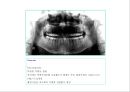 방사선사 국가고시 일반촬영 정리 (일반 영상검사, 일반 촬영, Lower extremity, Hip & pelvis, Spine, Mamo 촬영, 일반촬영 모의고사).ppt 25페이지