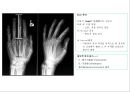 방사선사 국가고시 일반촬영 정리 (일반 영상검사, 일반 촬영, Lower extremity, Hip & pelvis, Spine, Mamo 촬영, 일반촬영 모의고사).ppt 27페이지