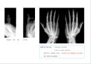 방사선사 국가고시 일반촬영 정리 (일반 영상검사, 일반 촬영, Lower extremity, Hip & pelvis, Spine, Mamo 촬영, 일반촬영 모의고사).ppt 28페이지
