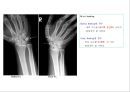 방사선사 국가고시 일반촬영 정리 (일반 영상검사, 일반 촬영, Lower extremity, Hip & pelvis, Spine, Mamo 촬영, 일반촬영 모의고사).ppt 30페이지