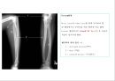 방사선사 국가고시 일반촬영 정리 (일반 영상검사, 일반 촬영, Lower extremity, Hip & pelvis, Spine, Mamo 촬영, 일반촬영 모의고사).ppt 34페이지