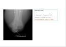 방사선사 국가고시 일반촬영 정리 (일반 영상검사, 일반 촬영, Lower extremity, Hip & pelvis, Spine, Mamo 촬영, 일반촬영 모의고사).ppt 37페이지