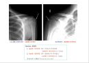 방사선사 국가고시 일반촬영 정리 (일반 영상검사, 일반 촬영, Lower extremity, Hip & pelvis, Spine, Mamo 촬영, 일반촬영 모의고사).ppt 40페이지