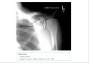 방사선사 국가고시 일반촬영 정리 (일반 영상검사, 일반 촬영, Lower extremity, Hip & pelvis, Spine, Mamo 촬영, 일반촬영 모의고사).ppt 41페이지
