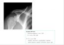 방사선사 국가고시 일반촬영 정리 (일반 영상검사, 일반 촬영, Lower extremity, Hip & pelvis, Spine, Mamo 촬영, 일반촬영 모의고사).ppt 44페이지