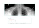 방사선사 국가고시 일반촬영 정리 (일반 영상검사, 일반 촬영, Lower extremity, Hip & pelvis, Spine, Mamo 촬영, 일반촬영 모의고사).ppt 48페이지