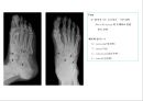 방사선사 국가고시 일반촬영 정리 (일반 영상검사, 일반 촬영, Lower extremity, Hip & pelvis, Spine, Mamo 촬영, 일반촬영 모의고사).ppt 50페이지